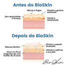 [COMPRE 1 LEVE 3] BioSkin™ - Máscara de Lipo Facial + Brinde Exclusivo